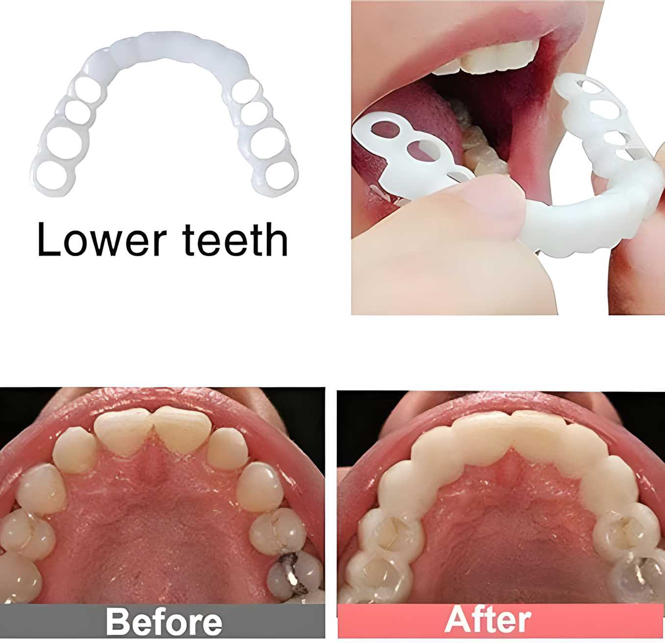 2pcs Whitening Teeth Guard for Grinding Protection