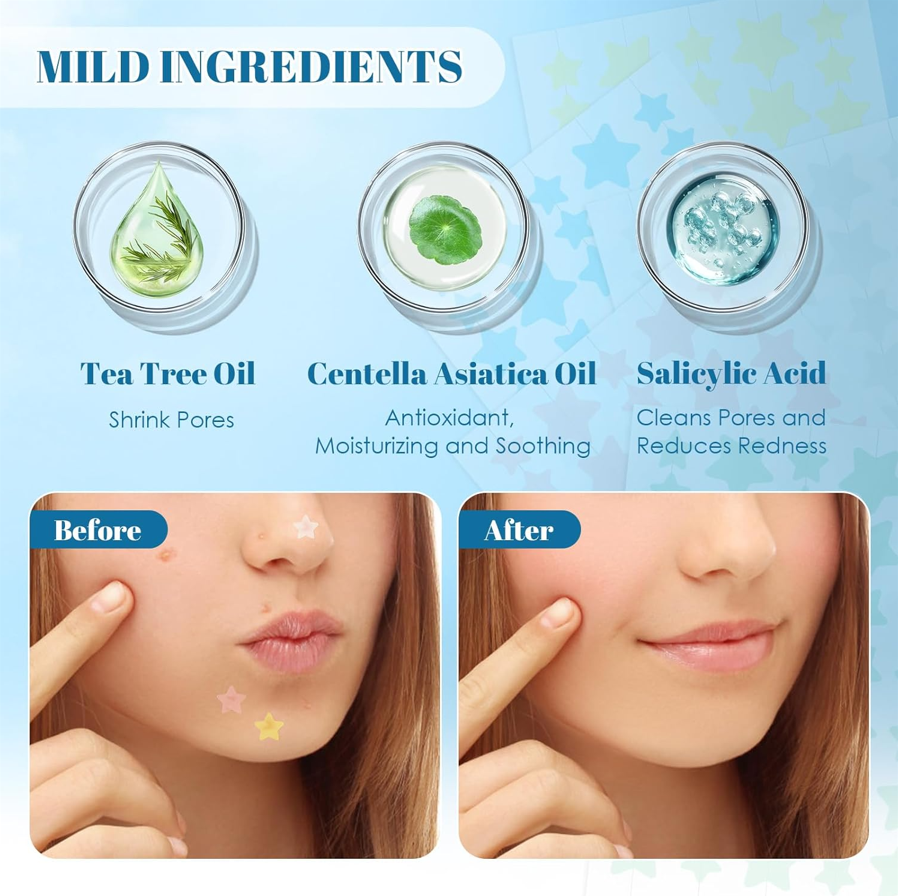 Acne Pimple Patches