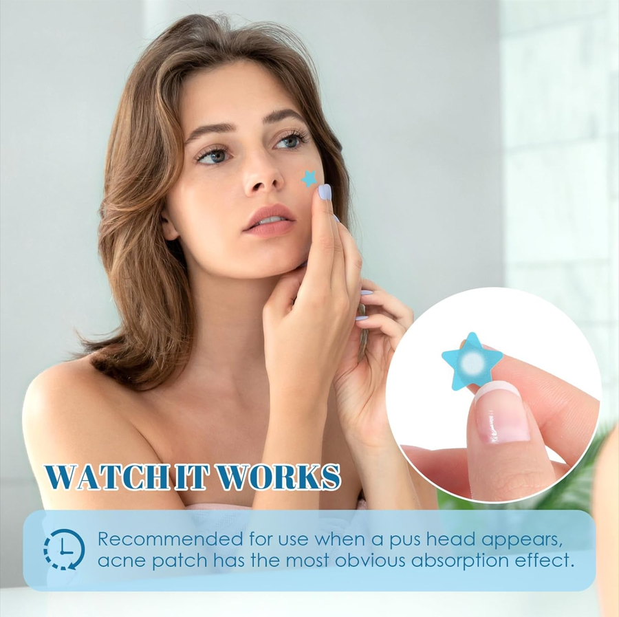 Acne Pimple Patches