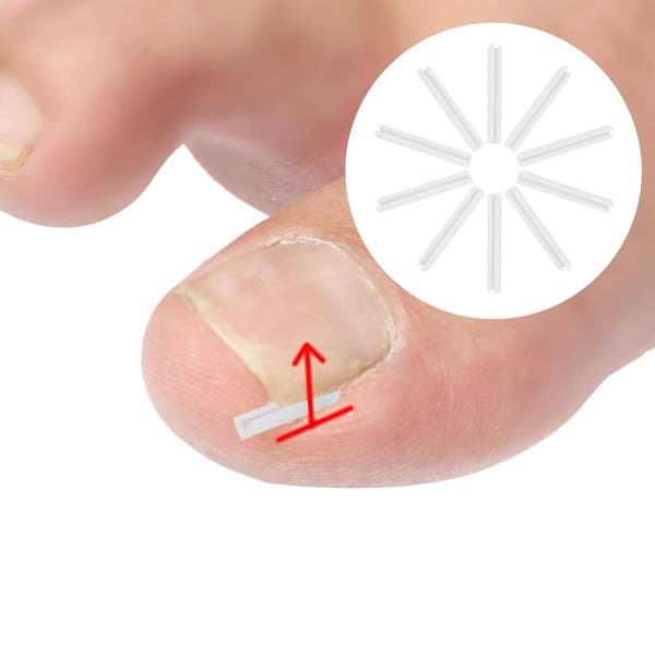 Toenail Relief Strips set