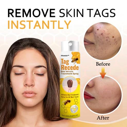 Bee Venom Skin Tag Removal Spray