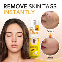 Bee Venom Skin Tag Removal Spray