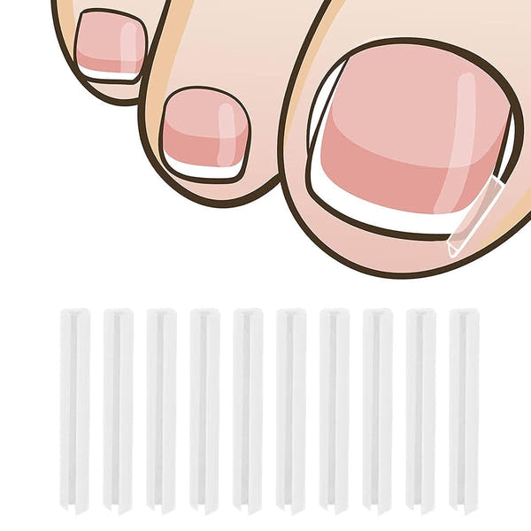 Toenail Relief Strips set