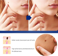 Herbal Wart Remover Cream