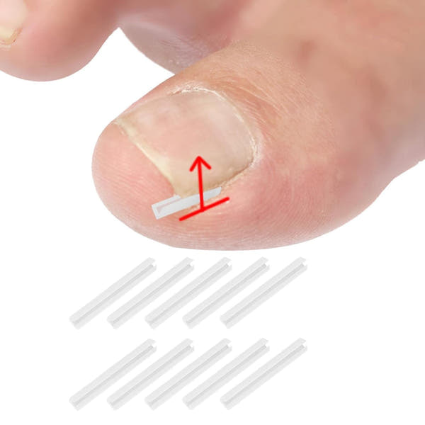 Toenail Relief Strips set