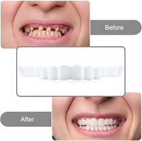 2pcs Whitening Teeth Guard for Grinding Protection