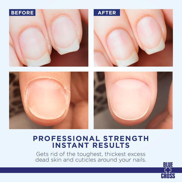 Blue Cross Cuticle Remover