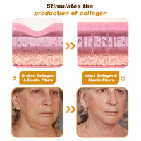 Wrinkle Removal & Firming Bee Venom Cream