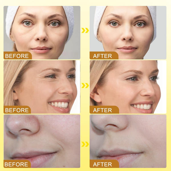 Wrinkle Removal & Firming Bee Venom Cream