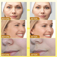 Wrinkle Removal & Firming Bee Venom Cream
