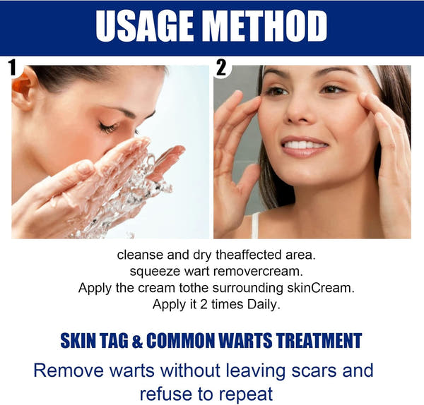 Herbal Wart Remover Cream