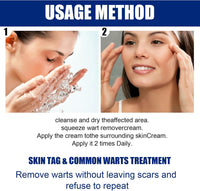 Herbal Wart Remover Cream