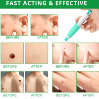 Painless Skin Tag, Mole, and Wart Removal Kit