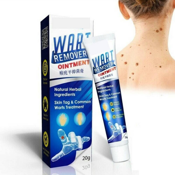 Wart Remover Cream