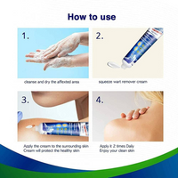 Wart Remover Cream