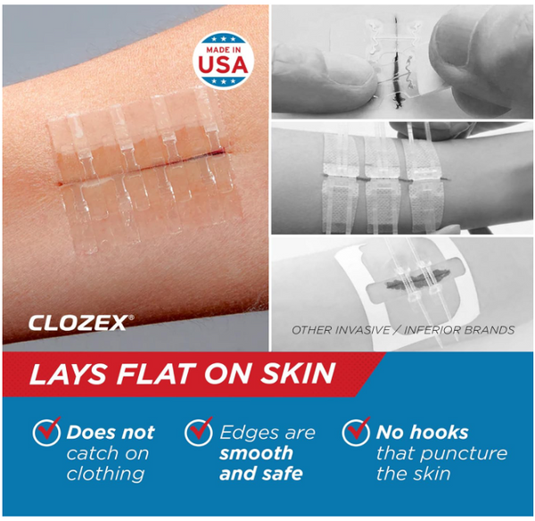 Emergency Laceration Closures
