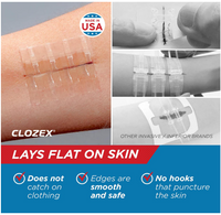 Emergency Laceration Closures