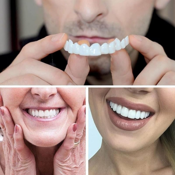 Instant Perfect Smile Veneers