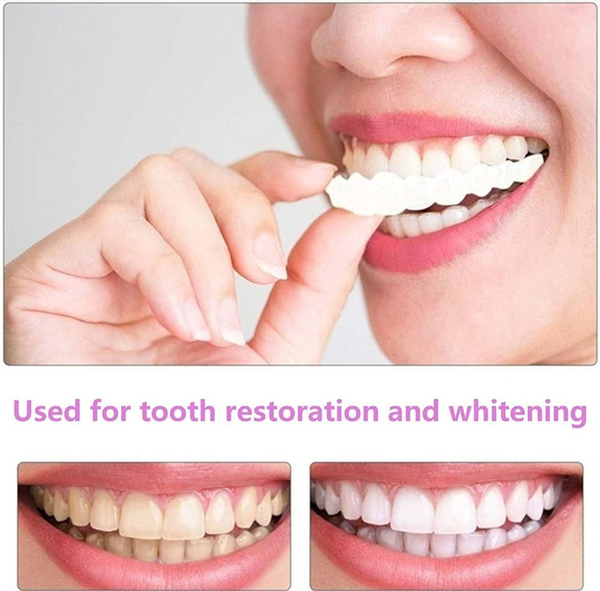 Instant Perfect Smile Veneers