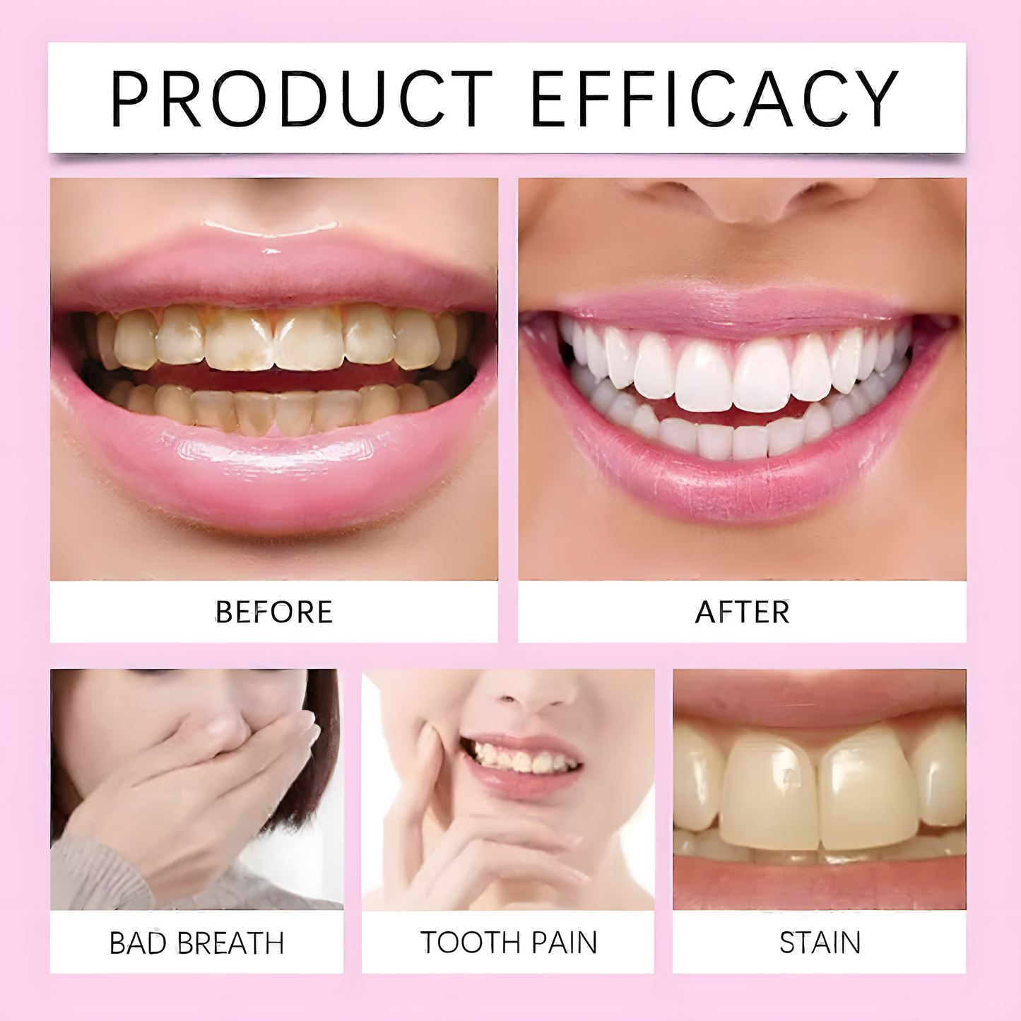 Teeth Whitening Strips
