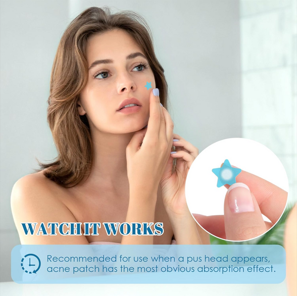 Acne Pimple Patches