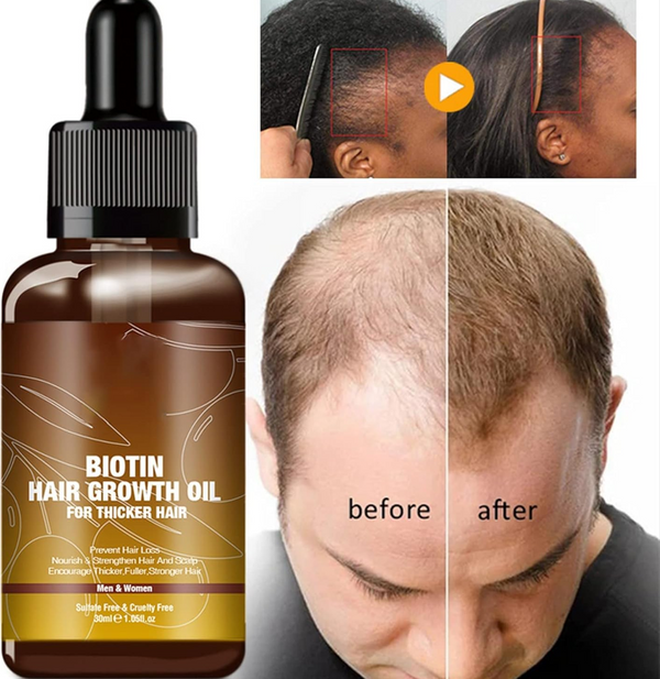 Hair Growth & Thickening Shampoo + Conditioner Set