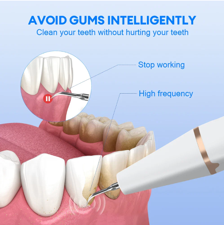 Electric Teeth Cleaner & Stain Remover