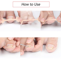 Toenail Correction Strips