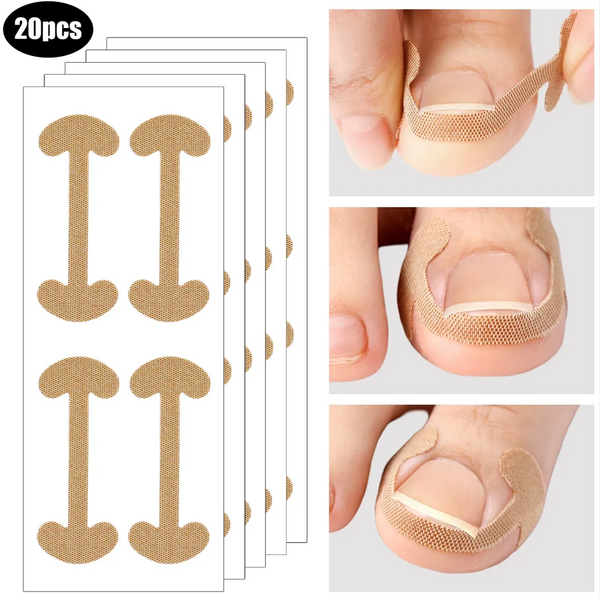 Toenail Correction Strips